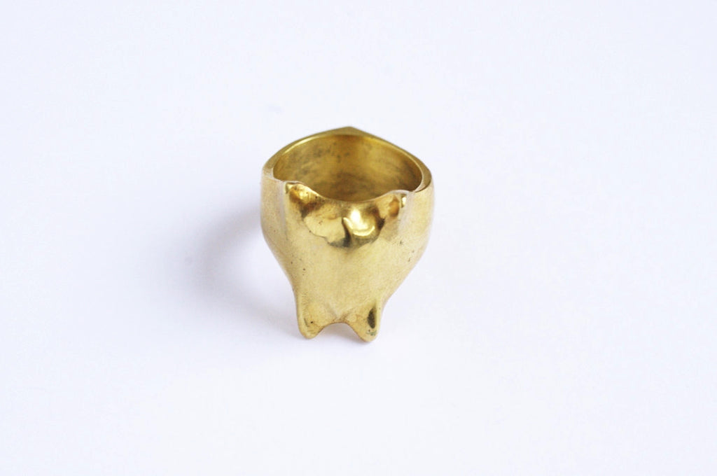 Backbone ring 1